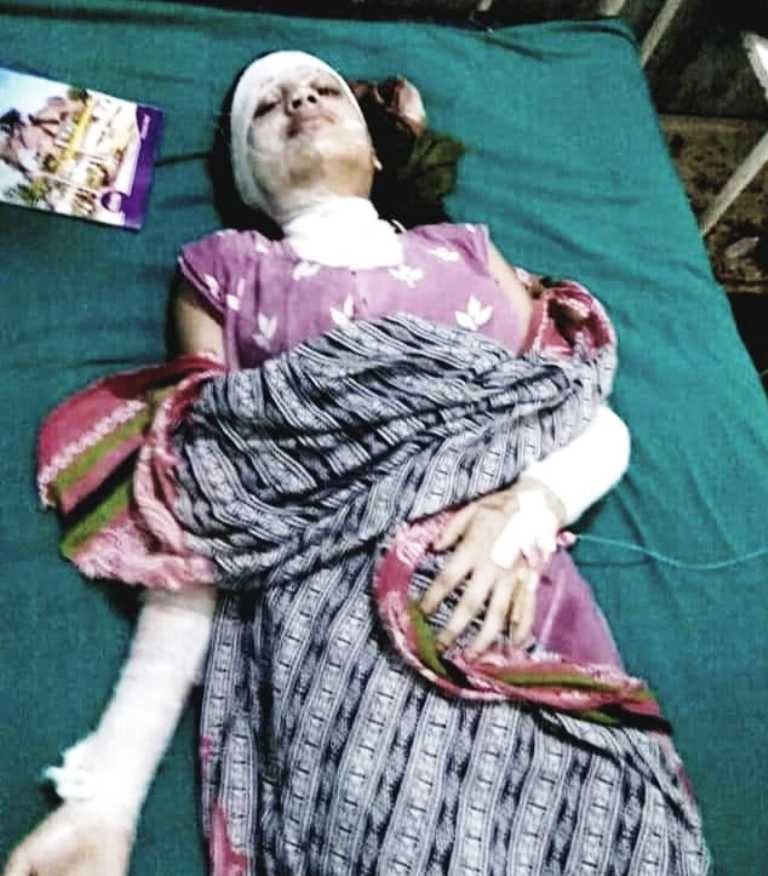 मुस्कान माथि एसिड प्रहार गर्नेलाई बालसुधार गृह पठाइयो